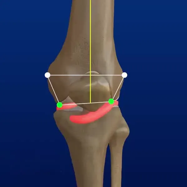 Diagram of knee support